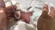 Menor bebê do sexo masculino sobrevive a parto prematuro - Reprodução/Universidade de Keio