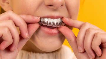 Especialista comenta 6 mitos e verdades sobre clareamento dental - Unsplash/Diana Polekhina