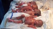 Apesar do aperto na barriga, os setes bebês nasceram saudáveis. - CEN/@Alroeya