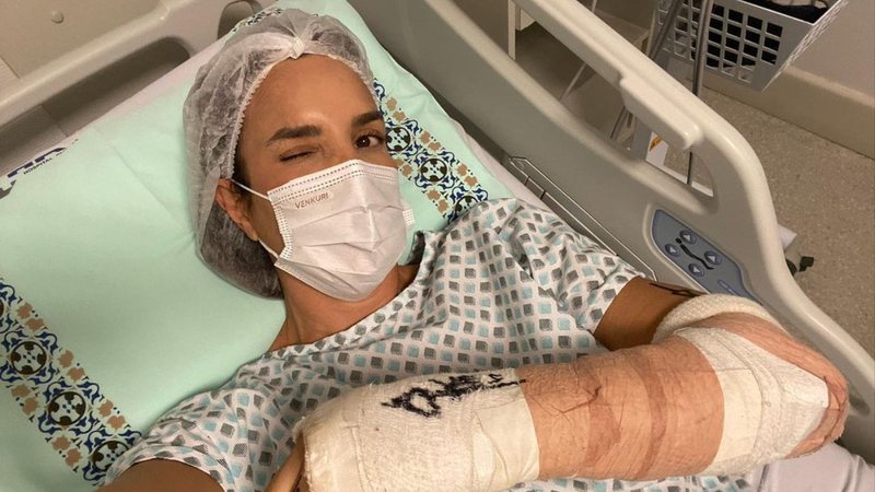 Ivete Sangalo se somete a una cirugía en el brazo y tranquiliza a los fanáticos: ‘Mainha es cero bala’