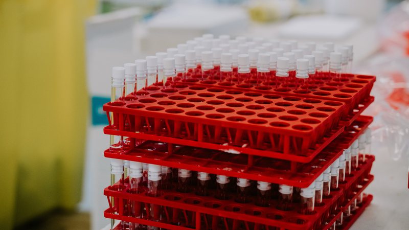 Ao todo serão 24 mil kits moleculares para diagnóstico laboratorial - Unsplash