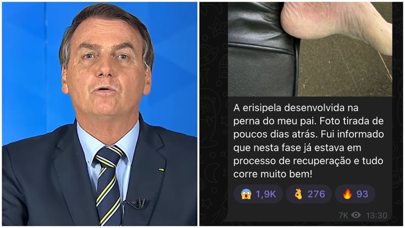 Lesão na perna de Bolsonaro pode ser razão para o presidente ter se afastado de suas funções. - YouTube/TV BRASILGOV