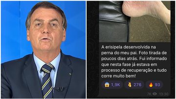 Lesão na perna de Bolsonaro pode ser razão para o presidente ter se afastado de suas funções. - YouTube/TV BRASILGOV