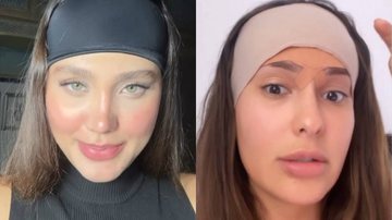 Especialista explica pré e pós-operatório da cirurgia para redução de testa: famosas como Biah Rodrigues e Thaís Braz fizeram - Instagram