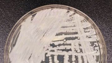 Fiocruz e Pasteur vão pesquisar sobre danos dos fungos no ser humano - CDC/Dr. Leanor Hailey