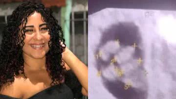 Sara Campos da Silva passou mal em ultrassom ao descobrir que espera gêmeos quíntuplos - Reprodução/Instagram