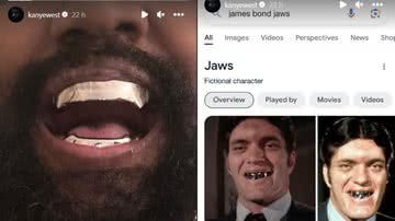 Kanye West troca dentes por prótese de titânio e se compara a personagem filme 'Jaws'. - Reprodução/Instagram