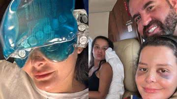 Maraisa sofreu acidente em piscina na última terça-feira (16), precisou ser hospitalizada, mas já recebeu alta - Reprodução/Instagram