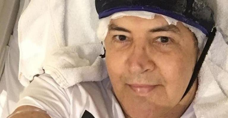 Beto Barbosa comentou sobre procedimento cirúrgico pós quimioterapia - Reprodução/Instagram