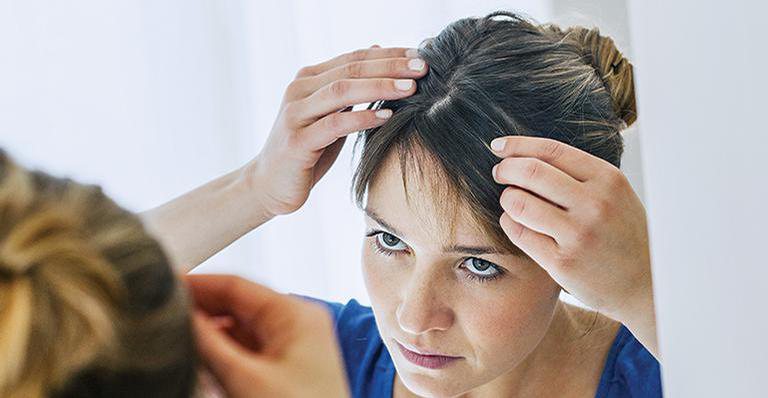 Você pode deixar seu cabelo menos oleoso - Shutterstock