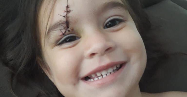 Pequena Isabella, de 2 anos, levou 6 pontos após sofrer acidente com garrafa de vidro que explodiu - Arquivo Pessoal