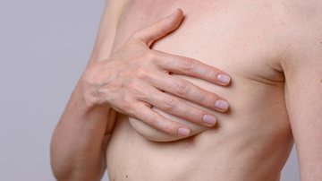 Os sintomas estão relacionados à dor na mama, principalmente próximo ao período da menstruação - Banco de Imagem/Getty Images