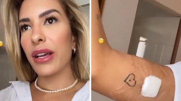 Lorena Improta revela dor ao retirar implante contraceptivo - Instagram/@lorenaimprota