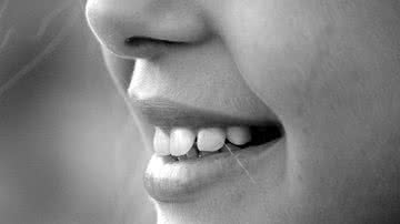 Veja o significado de sonhar com dentes - Giulia Marotta/Pixabay