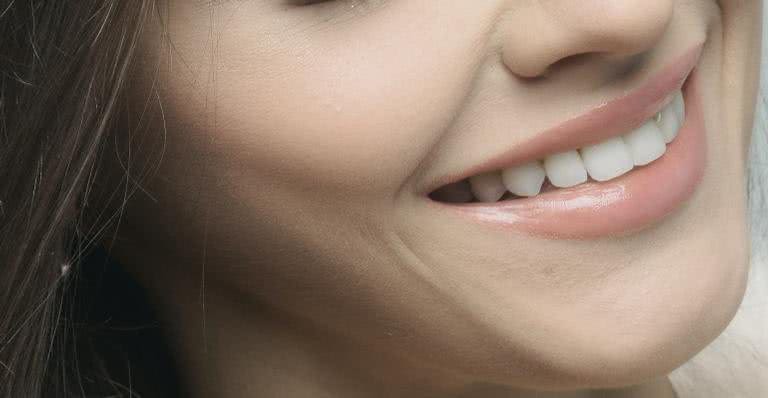 A lente de contato dental é indicada para a correção do formato dos dentes, cor, função e fonação - Alexander Krivitskiy/ Unsplash