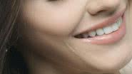 A lente de contato dental é indicada para a correção do formato dos dentes, cor, função e fonação - Alexander Krivitskiy/ Unsplash
