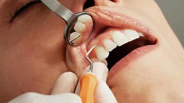 Equipe de cirurgiões-dentistas esclarecem inverdades sobre o assunto - Unsplash