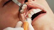 Equipe de cirurgiões-dentistas esclarecem inverdades sobre o assunto - Unsplash