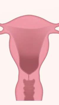Mioma no útero: entenda os seus riscos