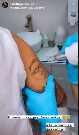 Mirella removendo tatuagem