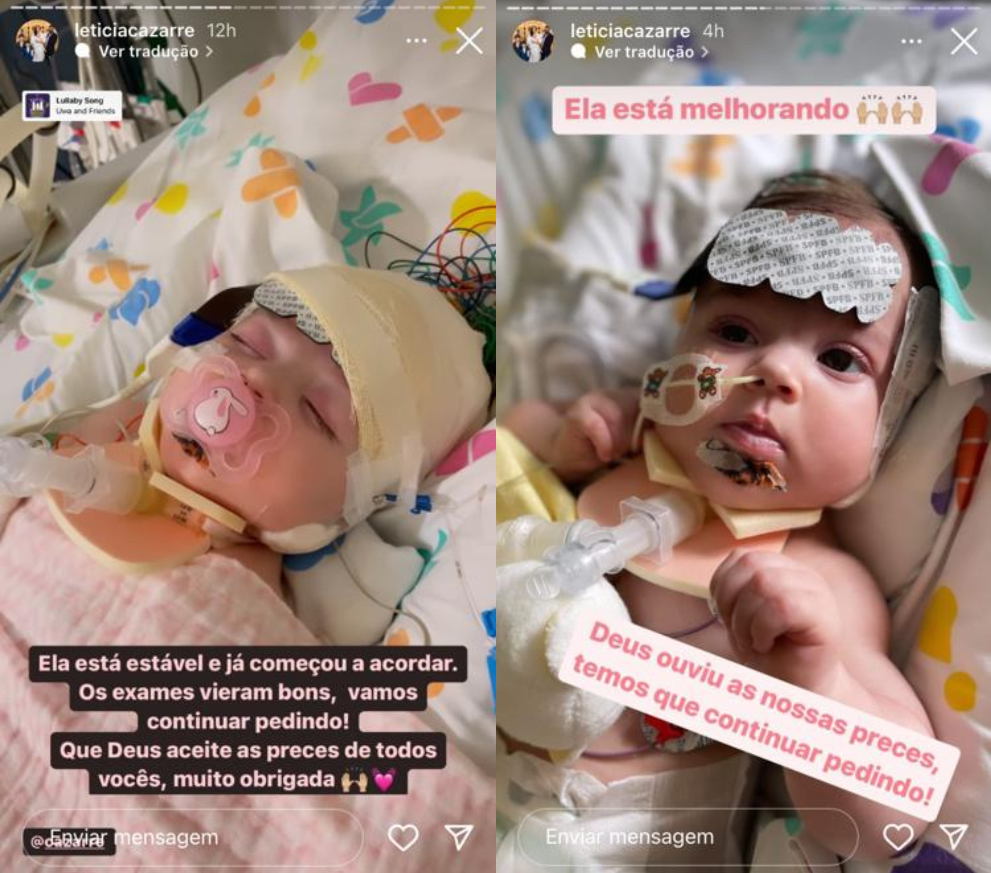 Dois Stories do Instagram da pequena Maria Guiilhermina com aparelhos médicos. Na primeira ela está domindo com uma chupeta na boca. Na segunda, ela está acordada com os bracinhos para cima