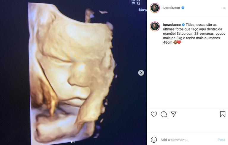 Lucas Lucco compartilha últimas fotos de ultrassom do filho, Luca